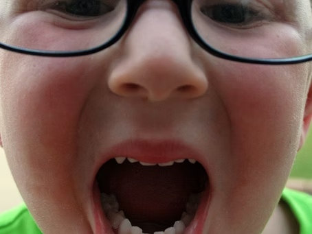 Young boy mouth opened